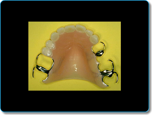 Protesis dentales 5